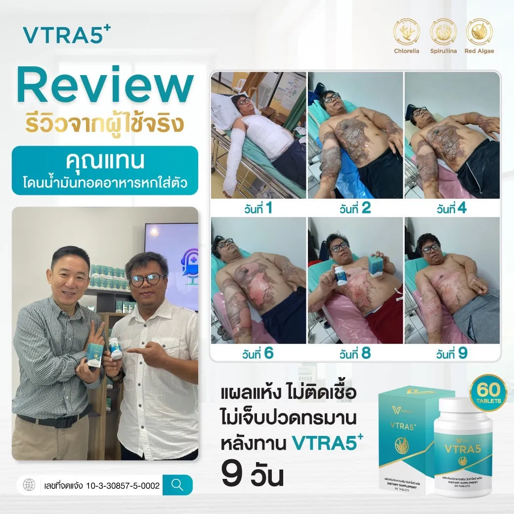 VTRA5+ วีตร้าไฟว์ พลัส อาหารเสริมลดคอเลสเตอรอล ลดไขมันในเลือด เสริมภูมิคุ้มกัน12